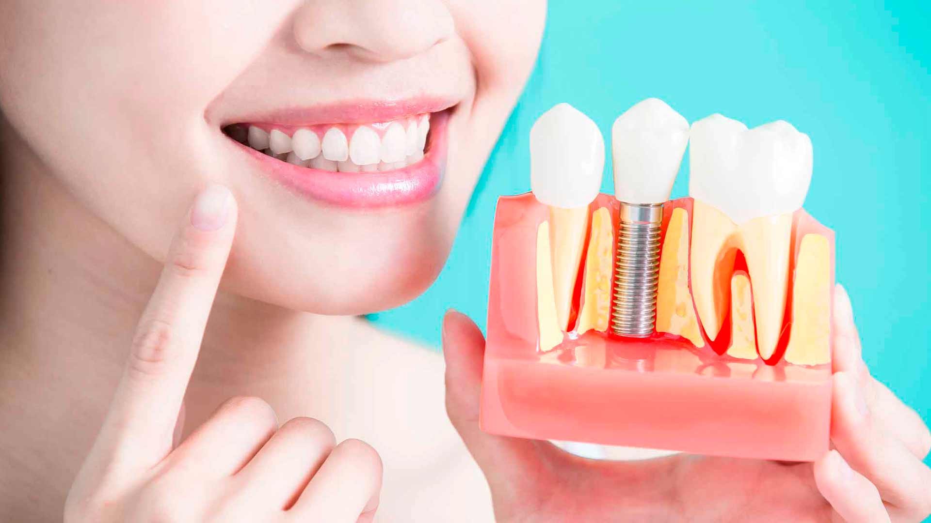 endodoncia